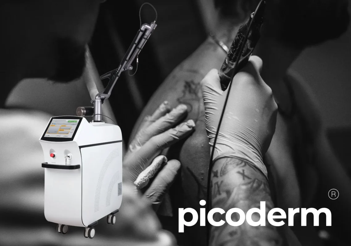 Máquina Picolaser de Picoderm utilizada para la eliminación precisa y eficaz de tatuajes y tratamientos de piel.