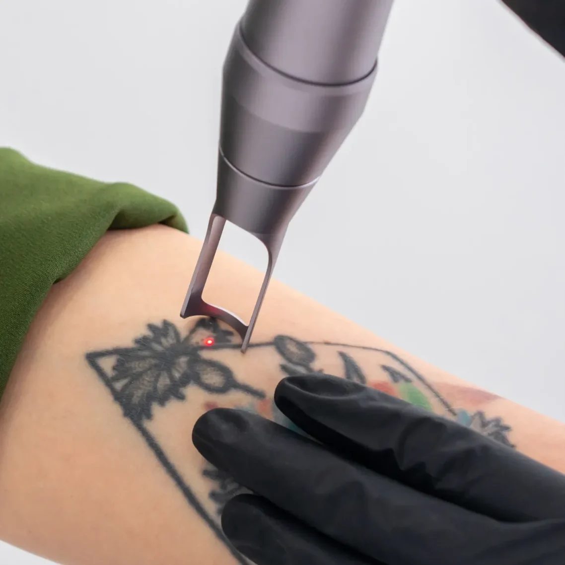 Eliminar Tattoo con máquina Picolaser de Picoderm modelo HK, equipada con tecnología avanzada SPT para la eliminación precisa y segura de tatuajes.